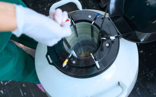 液氮罐補(bǔ)液